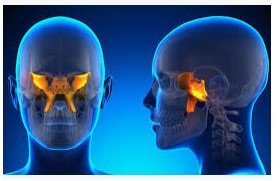 Neurocranial Restructuring: image showing the cranial bone