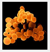 Menieres disease and food allergies - image of gut bacteria 