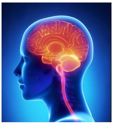 Meniere's Disease or Chiari malformation? This image shows chiari malformation under the brain