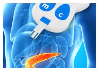 Glucose test and image of pancreas - Diabetes and Meniere's disease